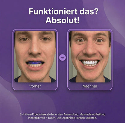 Purple Whitening Strips
